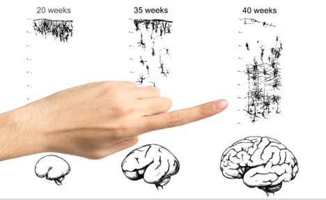 Drawing Milestones - The OT Toolbox