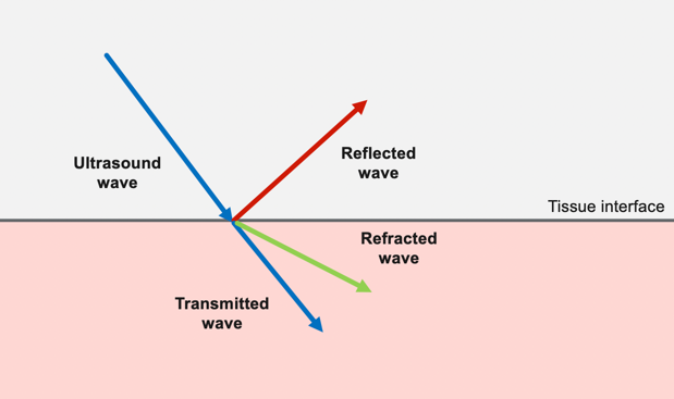 Attenuation of an ultrasound wave