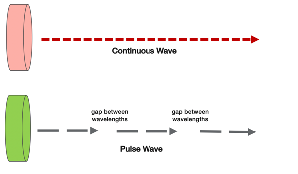 Examples of ultrasound waves