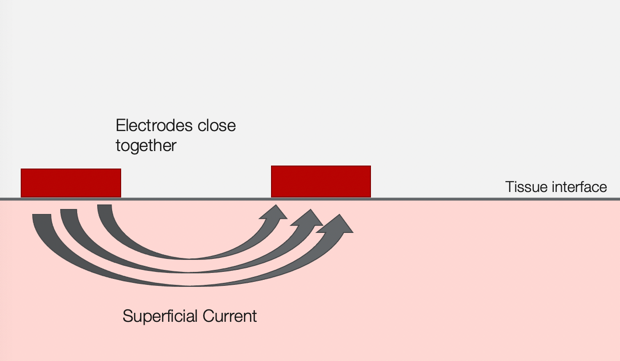 Example of a superficial current
