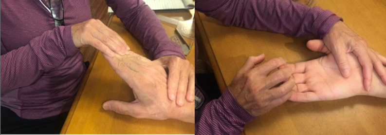 Manual muscle testing of fingers
