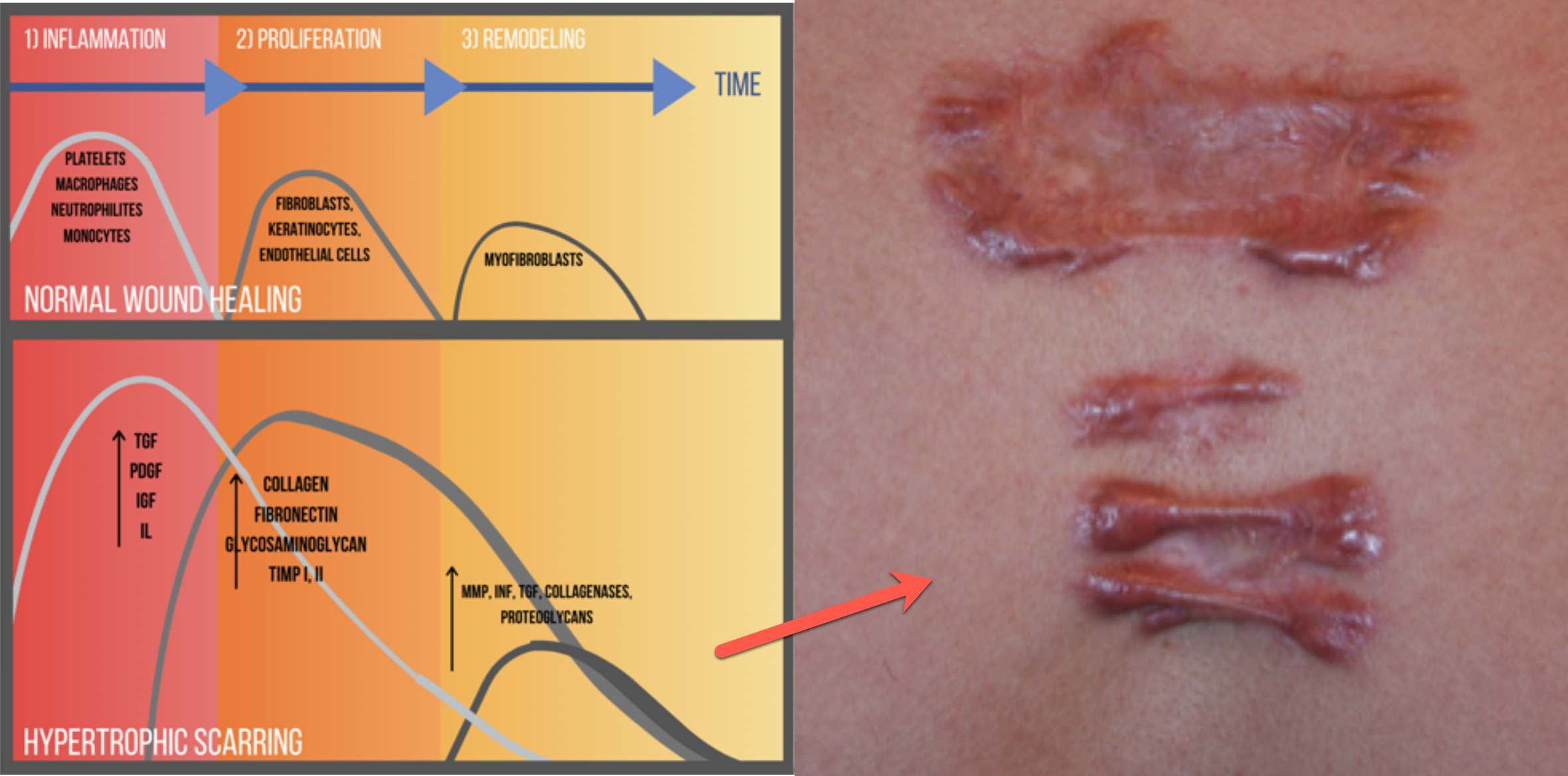 Wound healing over time with chart and example