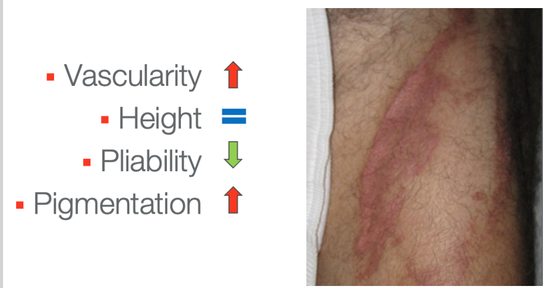 Scar example on a limb