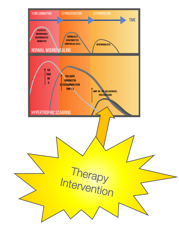 Best stage to intervene for scar management