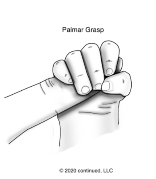 Drawing of the palmar grasp reflex