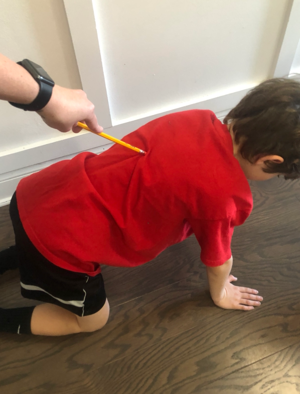 Testing for the Spinal Galant reflex with the child in quadruped and using a pencil eraser