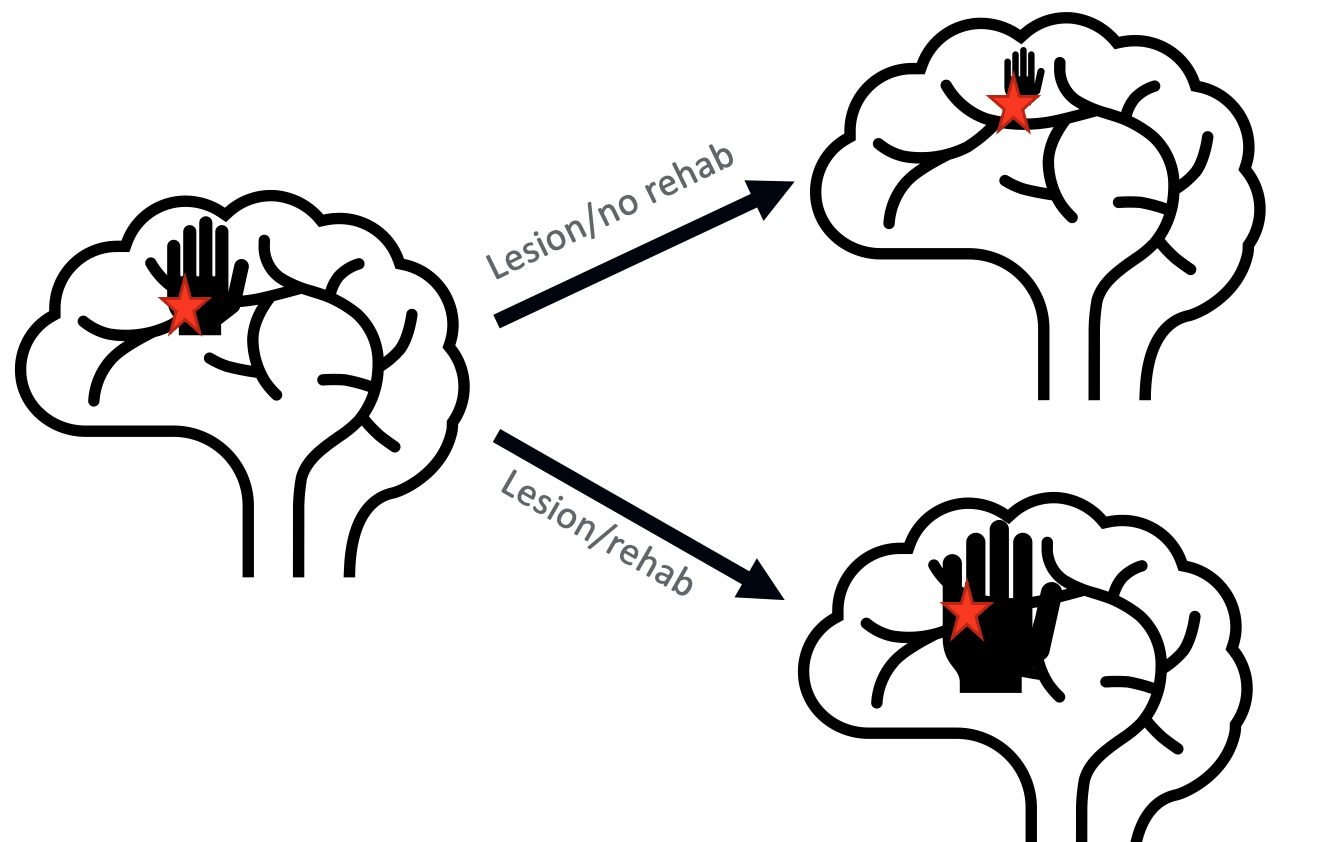 A schemata of monkey brains after a stroke with and without rehab showing better results after intervention