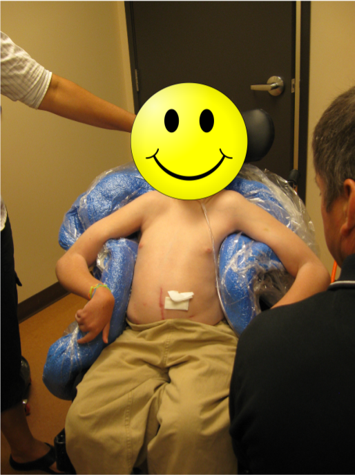 Boy with skeletal deformities in a custom molded seating system