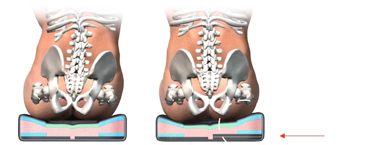 Figure 45