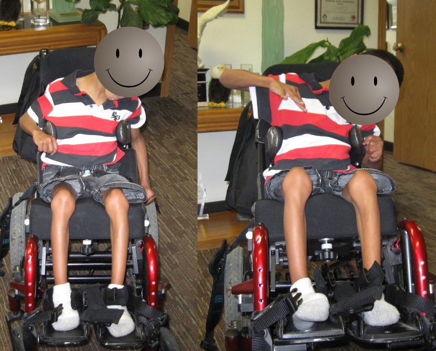 Smart Wheelchair Cushion, Adaptable Prosthetics Technology Receives Patent  - Rehab Management